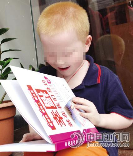 7岁男孩天生白化病